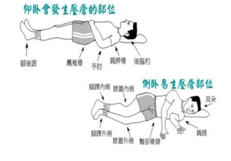 翻身擺位|如何正確協助臥床個案翻身擺位